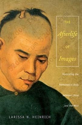 The Afterlife of Images: Translating the Pathological Body between China and the West