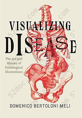 Visualizing Disease: The Art and History of Pathological Illustrations